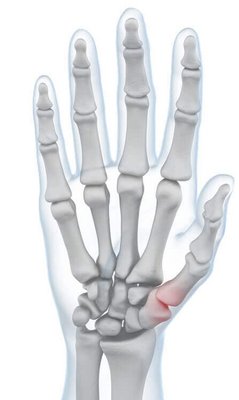 Illustration der Anatomie der Hand bei auftretenden Schmerzen im Daumengelenk